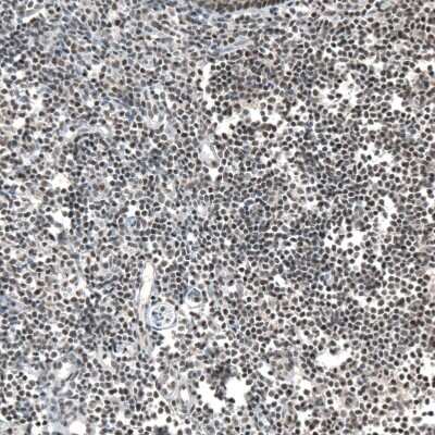 Immunohistochemistry-Paraffin: PHF15 Antibody [NBP1-81531] - Staining of human tonsil shows moderate nuclear positivity in non-germinal center cells.