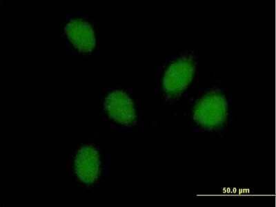 Immunocytochemistry/Immunofluorescence: PHF16 Antibody [H00009767-B01P] - Analysis of purified antibody to PHF16 on HeLa cell. (antibody concentration 10 ug/ml)