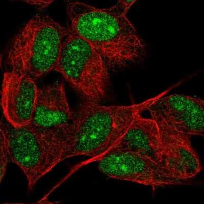 Immunocytochemistry/ Immunofluorescence PHF16 Antibody