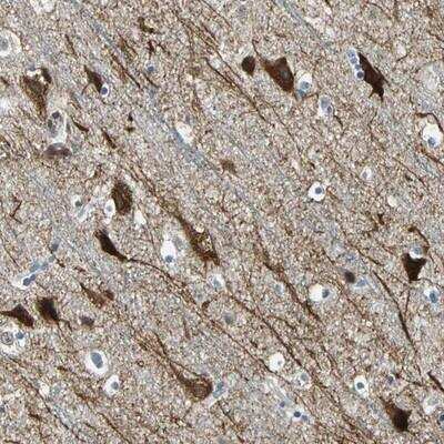 Immunohistochemistry-Paraffin: PHF16 Antibody [NBP1-83022] - Staining of human cerebral cortex shows strong cytoplasmic and nuclear positivity in neuronal cells.