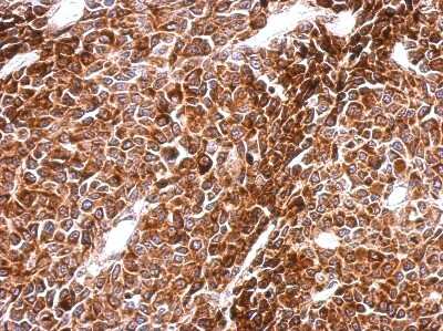 Immunohistochemistry-Paraffin: PHF16 Antibody [NBP2-19796] - BT483 xenograft, using PHF16  antibody at 1:500 dilution. Antigen Retrieval: Trilogy™ (EDTA based, pH 8.0) buffer, 15min.