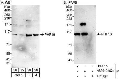 Immunoprecipitation: PHF16 Antibody [NBP2-04021] - Samples: Whole cell lysate from HeLa (15 and 50 ug for WB; 1 mg for IP, 20% of IP loaded), 293T (T; 50 ug) and Jurkat (J; 50 ug) cells. Antibodies: Affinity purified rabbit anti-PHF16 antibody NBP2-04021 used for WB at 0.4 ug/ml (A) and 1 ug/ml (B) and used for IP at 6 ug/mg lysate. PHF16 was also immunoprecipitated by rabbit anti-PHF16 antibody, which recognizes an upstream epitope. Detection: Chemiluminescence with exposure times of 3 minutes (A and