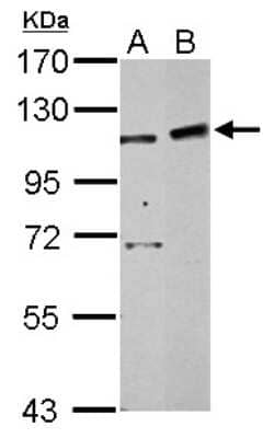 Western Blot: PHF16 Antibody [NBP2-19796] - Sample (30 ug of whole cell lysate) A: 293T B: HepG2 7. 5% SDS PAGE gel, diluted at 1:500.