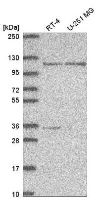 Western Blot PHF16 Antibody