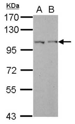 Western Blot: Jade-1/PHF17 Antibody [NBP2-19797] -  Sample (30 ug of whole cell lysate) A: HeLa B: HepG2 7. 5% SDS PAGE gel, diluted at 1:500.