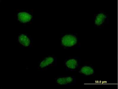 Immunocytochemistry/Immunofluorescence: PHF19 Antibody [H00026147-B01P] - Analysis of purified antibody to PHF19 on HeLa cell. (antibody concentration 10 ug/ml)