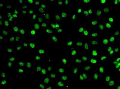 Immunocytochemistry/ Immunofluorescence PHF19 Antibody - Azide and BSA Free