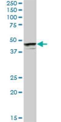 Western Blot: PHF19 Antibody [H00026147-B01P] - PHF19 MaxPab polyclonal antibody. Western Blot analysis of PHF19 expression in human pancreas.