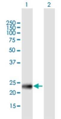 Western Blot: PHF19 Antibody [H00026147-B01P] - Analysis of PHF19 expression in transfected 293T cell line by PHF19 polyclonal antibody.  Lane1:PHF19 transfected lysate(22.77 KDa). Lane2:Non-transfected lysate.