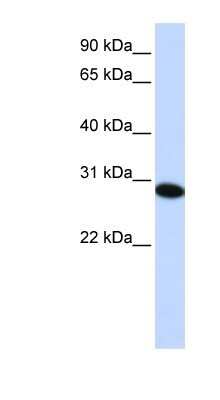 Western Blot: PHF19 Antibody [NBP1-79352] - Titration: 0.2-1 ug/ml, Positive Control: HepG2 cell lysate.