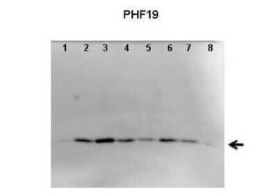 Western Blot: PHF19 Antibody [NBP1-79352] - Titration: 1 ug/ml Positive Control: HBEC, A549, Calu-6, NCI358,NCI841, NCI1299, NCI1650 and NCI1975 cells.