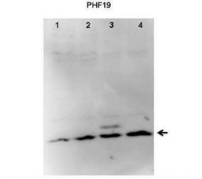 Western Blot PHF19 Antibody - BSA Free