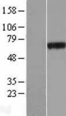 Western Blot: PHF19 Overexpression Lysate (Adult Normal) [NBP2-07134] Left-Empty vector transfected control cell lysate (HEK293 cell lysate); Right -Over-expression Lysate for PHF19.