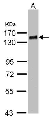 Western Blot: PHF20 Antibody [NBP1-32464] - Sample(30 ug whole cell lysate)A:MOLT4  7. 5% SDS PAGE, antibody diluted at 1:1000.