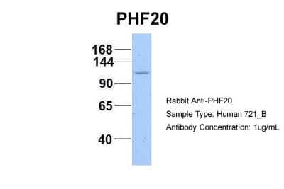 Western Blot: PHF20 Antibody [NBP2-88044] - Host: Rabbit. Target Name: WT1. Sample Type: 721_B. Antibody Dilution: 1.0ug/mlPHF20 is strongly supported by BioGPS gene expression data to be expressed in Human 721_B cells