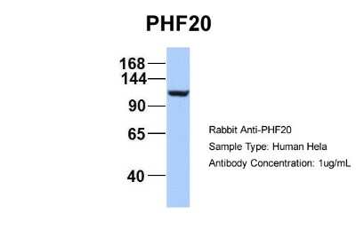 Western Blot: PHF20 Antibody [NBP2-88044] - Host: Rabbit. Target Name: EGFL8. Sample Type: Hela. Antibody Dilution: 1.0ug/mlPHF20 is strongly supported by BioGPS gene expression data to be expressed in HeLa
