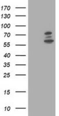 Western Blot: PHF21B Antibody (3G9) [NBP2-00877] HEK293T cells were transfected with the pCMV6-ENTRY control (Left lane) or pCMV6-ENTRY PHF21B (Right lane) cDNA for 48 hrs and lysed. Equivalent amounts of cell lysates (5 ug per lane) were separated by SDS-PAGE and immunoblotted with anti-PHF21B.