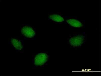 Immunocytochemistry/Immunofluorescence: PHF21B Antibody [H00112885-B01P] - Analysis of purified antibody to PHF21B on HeLa cell. (antibody concentration 10 ug/ml)