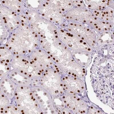 Immunohistochemistry-Paraffin: PHF21B Antibody [NBP2-30660] - Staining of human kidney shows strong nuclear positivity in cells in tubules.