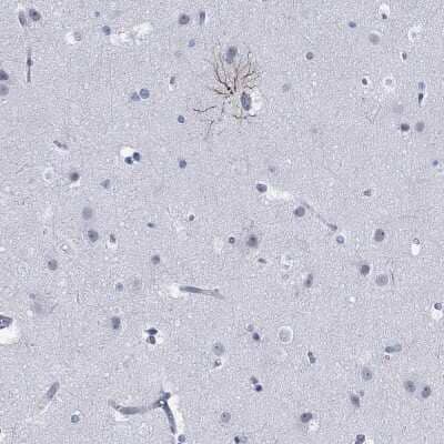 Immunohistochemistry-Paraffin: PHF21B Antibody [NBP3-17085] - Staining of human cerebral cortex shows high expression.