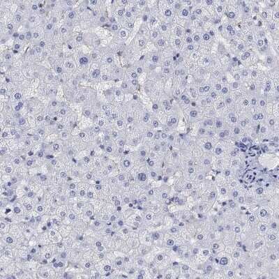 Immunohistochemistry-Paraffin: PHF21B Antibody [NBP3-17085] - Staining of human liver shows low expression as expected.