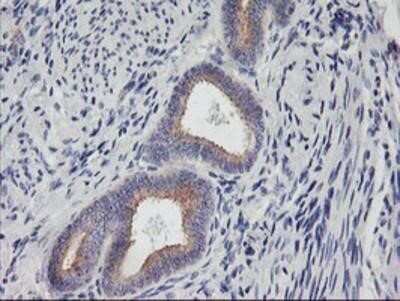 Immunohistochemistry: PHF21B Antibody (OTI3D1) - Azide and BSA Free [NBP2-73367] - Staining of paraffin-embedded Human endometrium tissue using anti-PHF21B mouse monoclonal antibody.