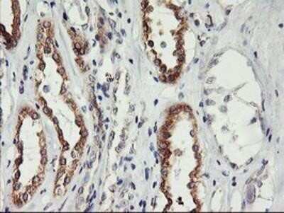 Immunohistochemistry: PHF21B Antibody (OTI3D1) - Azide and BSA Free [NBP2-73367] - Staining of paraffin-embedded Human Kidney tissue using anti-PHF21B mouse monoclonal antibody.