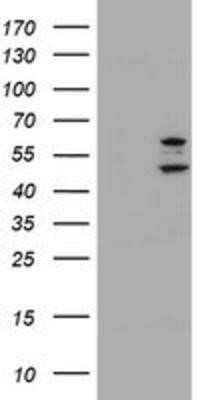 Western Blot PHF21B Antibody (OTI3D1) - Azide and BSA Free