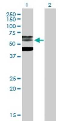 Western Blot: PHF21B Antibody [H00112885-B01P] - Analysis of PHF21B expression in transfected 293T cell line by PHF21B polyclonal antibody.  Lane 1: PHF21B transfected lysate(58.41 KDa). Lane 2: Non-transfected lysate.