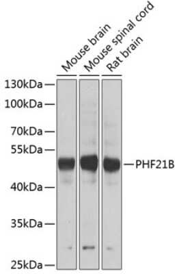 Western Blot: PHF21B Antibody [NBP2-94425] - Analysis of extracts of various cell lines, using PHF21B at 1:1000 dilution. Secondary antibody: HRP Goat Anti-Rabbit IgG (H+L) at 1:10000 dilution. Lysates/proteins: 25ug per lane. Blocking buffer: 3% nonfat dry milk in TBST. Detection: ECL Basic Kit . Exposure time: 90s.