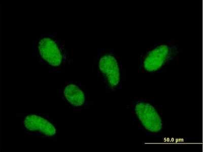 Immunocytochemistry/ Immunofluorescence PHF22 Antibody - Azide and BSA Free