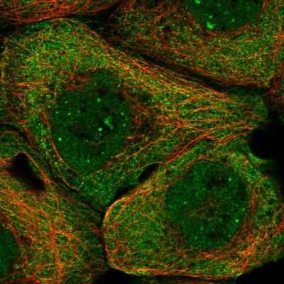 Immunocytochemistry/ Immunofluorescence PHF22 Antibody - BSA Free