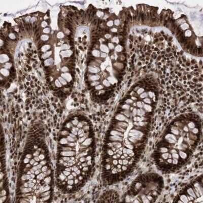 Immunohistochemistry-Paraffin PHF22 Antibody - BSA Free