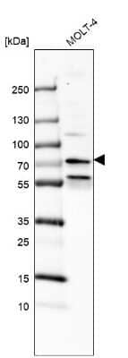 Western Blot PHF22 Antibody - BSA Free