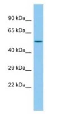 Western Blot: PHF22 Antibody [NBP3-09299] - Western blot analysis of PHF22 in Rat Pancreas lysates. Antibody dilution at 1.0ug/ml