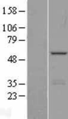 Western Blot PHF22 Overexpression Lysate