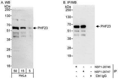 Western Blot: PHF23 Antibody [NBP1-28747] - Samples: Whole cell lysate (5, 15 and 50 ug for WB; 1 mg for IP, 20% of IP loaded) from HeLa cells.   Antibodies: Affinity purified rabbit anti-PHF23 antibody NBP1-28747 used for WB at 0.1 ug/ml (A) and 0.4 ug/ml (B) and used for IP at 10 ug/mg lysate.  PHF23 was also immunoprecipitated by rabbit anti-PHF23 antibody NBP1-28746, which recognizes an upstream epitope.  Detection: Chemiluminescence with exposure times of 30 seconds (A and B).