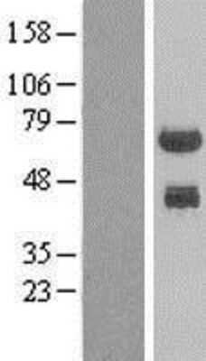 Western Blot: PHF23 Overexpression Lysate (Adult Normal) [NBL1-14359] Left-Empty vector transfected control cell lysate (HEK293 cell lysate); Right -Over-expression Lysate for PHF23.