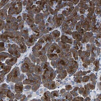 Immunohistochemistry-Paraffin PHF24 Antibody - BSA Free