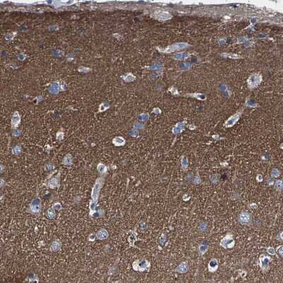 Immunohistochemistry-Paraffin PHF24 Antibody - BSA Free