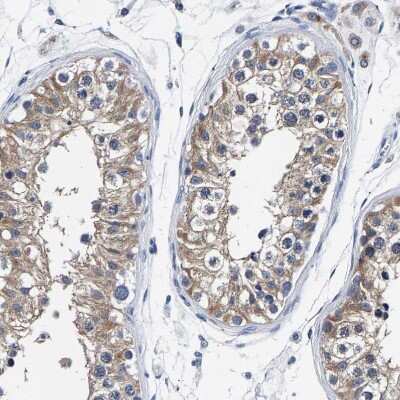 Immunohistochemistry-Paraffin PHF24 Antibody - BSA Free