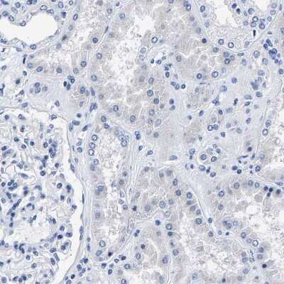 Immunohistochemistry-Paraffin PHF24 Antibody - BSA Free