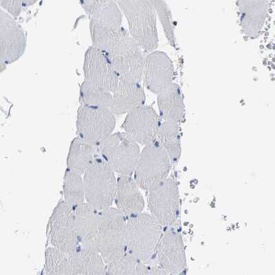 Immunohistochemistry-Paraffin PHF24 Antibody - BSA Free