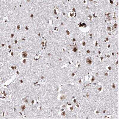 Immunohistochemistry-Paraffin: PHF5A Antibody [NBP1-88591] - Staining of human cerebral cortex shows strong nuclear positivity in neurons