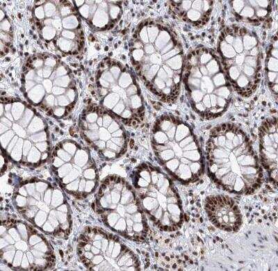 Immunohistochemistry-Paraffin: PHF5A Antibody [NBP1-88591] - Staining of human rectum shows strong nuclear positivity in glandular cells.