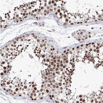 Immunohistochemistry-Paraffin: PHF5A Antibody [NBP1-88591] - Staining of human testis shows strong nuclear positivity in cells in seminiferous ducts.