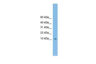 Western Blot: PHF5A Antibody [NBP2-83391] - WB Suggested Anti-PHF5A Antibody Titration: 0.2-1 ug/ml. ELISA Titer: 1:62500. Positive Control: OVCAR-3 cell lysate