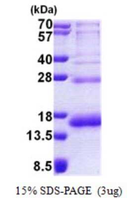 SDS-Page: PHF5A Protein [NBP2-23325]