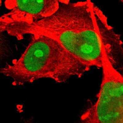 Immunocytochemistry/Immunofluorescence: PHF6 Antibody [NBP1-88646] - Staining of human cell line U-251MG shows positivity in nucleus and nucleoli. Antibody staining is shown in green.