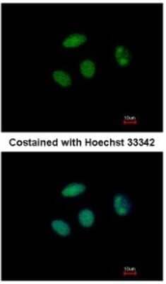 Immunocytochemistry/Immunofluorescence: PHF6 Antibody [NBP2-19799] - Analysis of paraformaldehyde-fixed MCF-7, using antibody at 1:500 dilution.